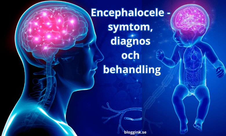 Encephalocele - symtom, diagnos och behandling....bloggink.se