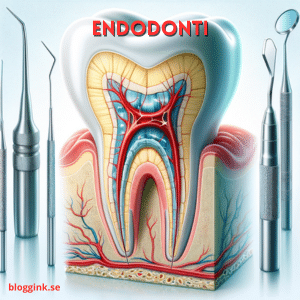 Endodonti...bloggink.se