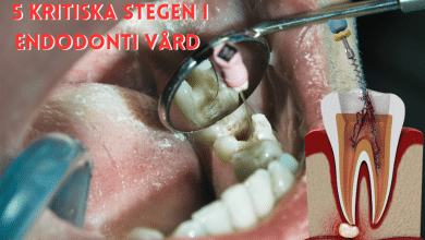 Endodonti...bloggink.se