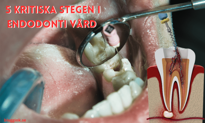 Endodonti...bloggink.se