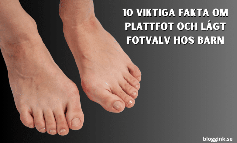 10 Viktiga Fakta om Plattfot och Lågt Fotvalv...bloggink.se