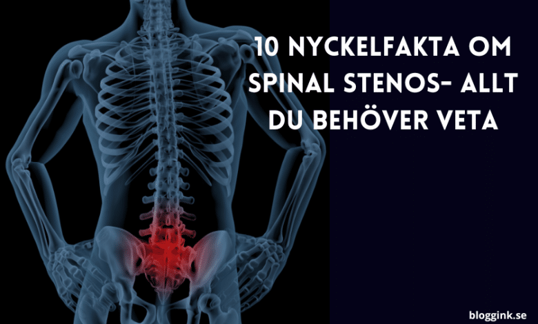 10 nyckelfakta om Spinal stenos- allt du...bloggink.se