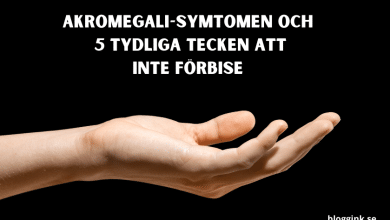 Akromegali-symtomen och 5 Tydliga tecken...bloggink.se