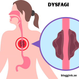 Dysfagi..bloggink.se