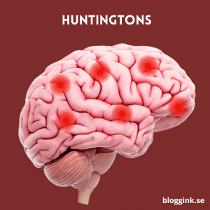 Huntingtons....bloggink.se 