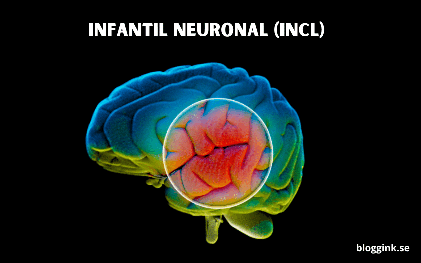 Infantil Neuronal (INCL)...bloggink.se