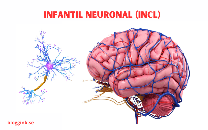 Infantil Neuronal (INCL)...bloggink.se