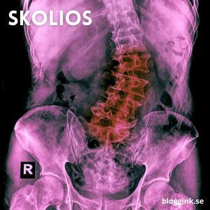 Skolios...bloggink.se